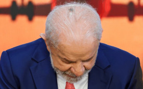 Lula passa por sess&atilde;o de radioterapia ap&oacute;s retirada de c&acirc;ncer de pele
