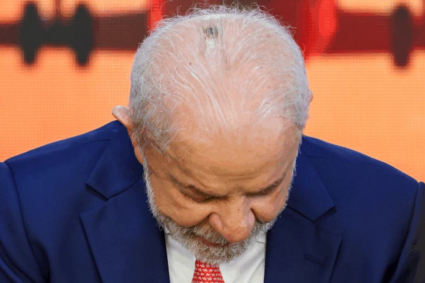 Lula passa por sess&atilde;o de radioterapia ap&oacute;s retirada de c&acirc;ncer de pele