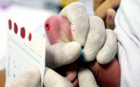 Nova Igua&ccedil;u faz mais de 4,5 mil testes do pezinho