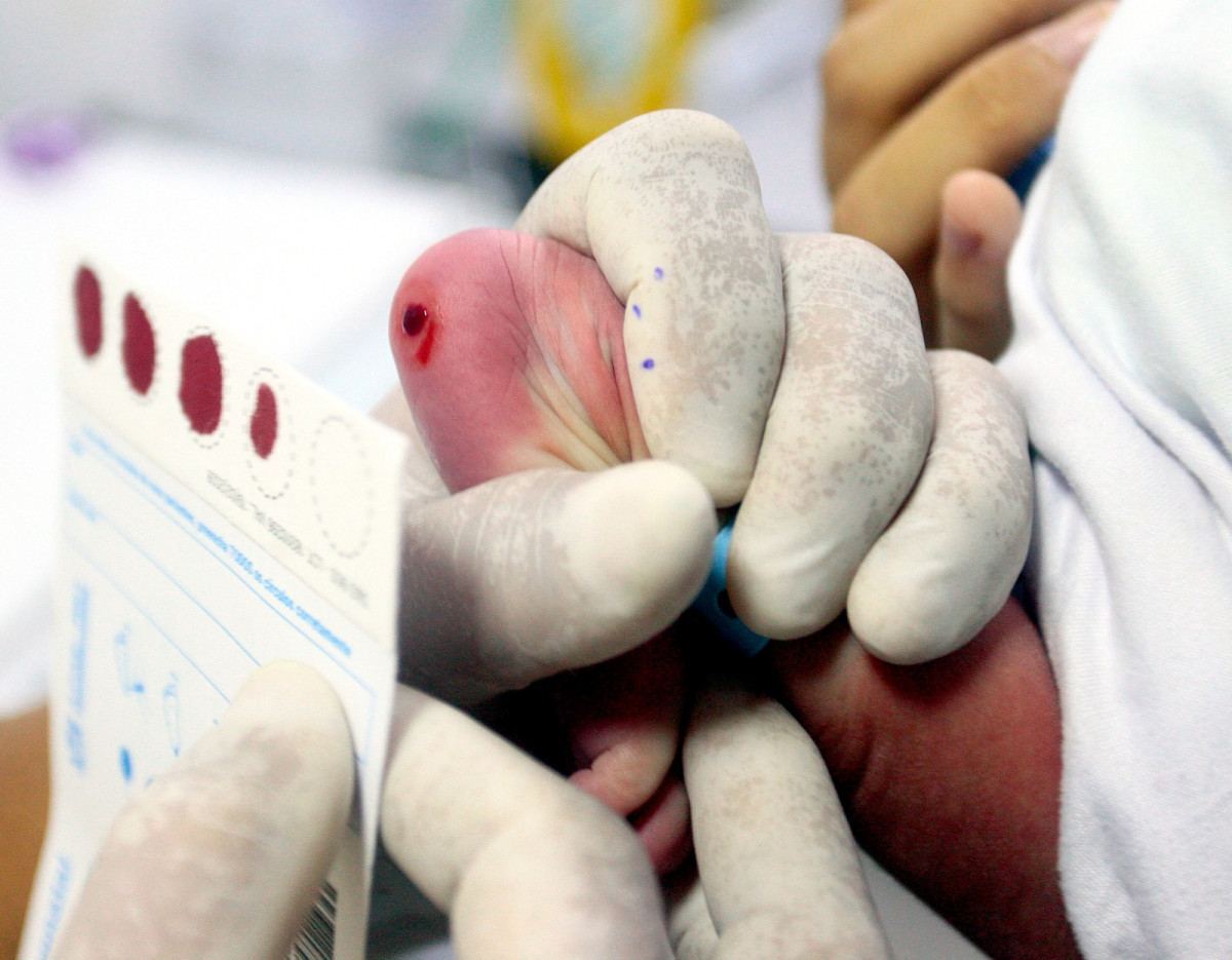 Nova Igua&ccedil;u faz mais de 4,5 mil testes do pezinho