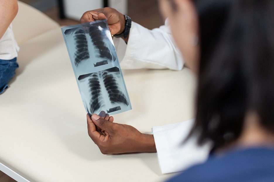 Saiba o que &eacute; adenocarcinoma pulmonar, c&acirc;ncer que atinge o papa