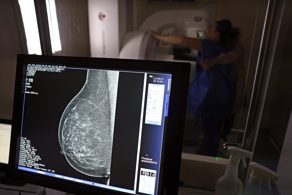 M&eacute;dicos lan&ccedil;am guia para evitar recusa de mamografia digital